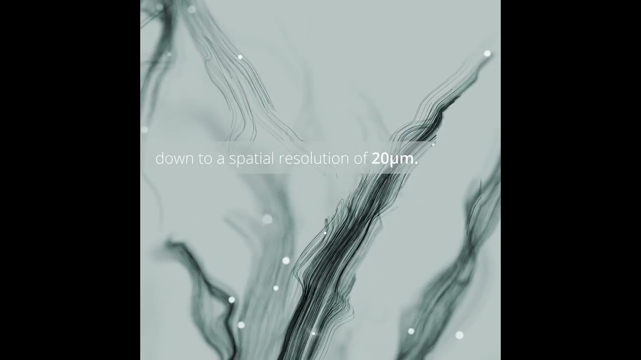 3D ultrasound microscopy of the mouse brain