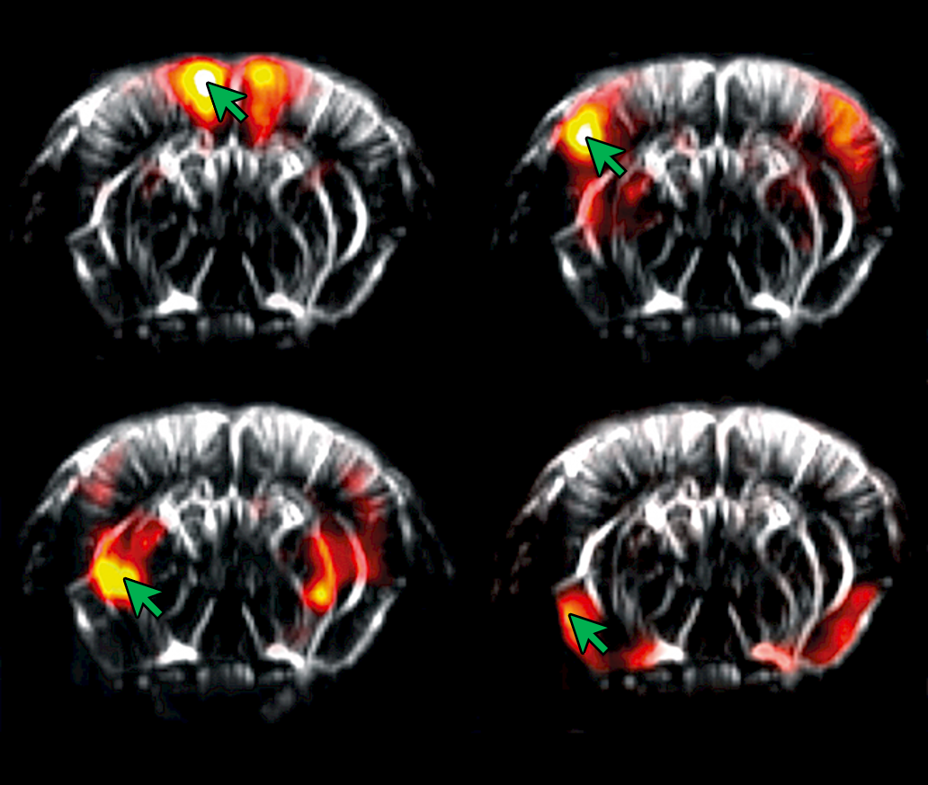 Seed-based correlation mapping was used here in a mouse model, with each panel showing the brain regions correlated with a single ‘seed’ region (green arrow).
