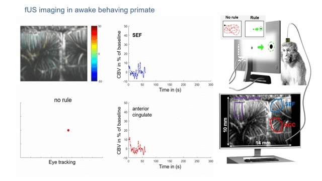 Using functional ultrasound neuroimaging, a dramatic increase in the activity of the supplementary eye field (SEF) and anterior cingulate cortex (ACC) is observed upon a change in saccade behavior in a macaque.