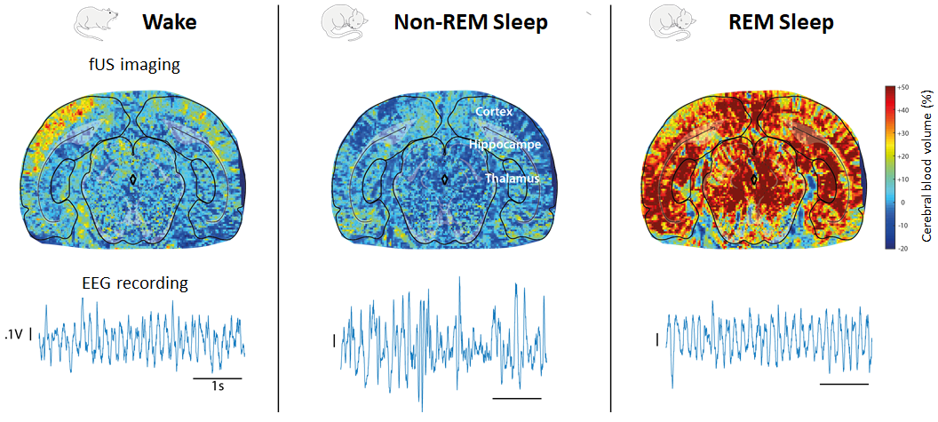 By using fUS in combination with EEG, ‘vascular surges’ (strong but transient increases of CBV) during sleep phases were detected for the first time in rodents. This phenomenon had previously only been seen in humans, and suggests that it has an important evolutionary benefit.