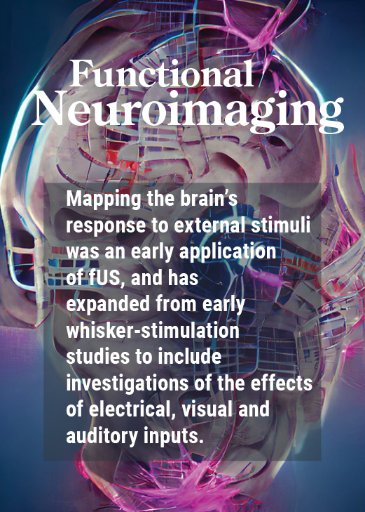 applications : functional neuroimaging