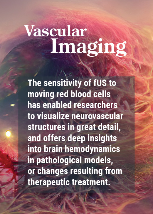 Iconeus applications : vascular imaging