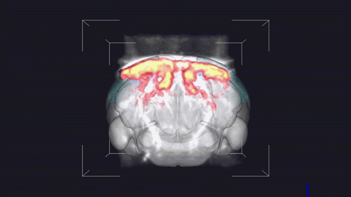 Whole-brain functional ultrasound activation map acquired on Iconeus One following pulsed visual stimulation in an anesthetized mouse. Regions with significant activation (color scale) are superimposed on the pre-acquired brain vasculature (grey scale), showing increased blood flows in the visual cortices, lateral geniculate nuclei and superior colliculi.
