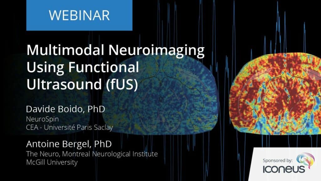 multimodal neuroimaging using functional ultrasound (fus) sm1