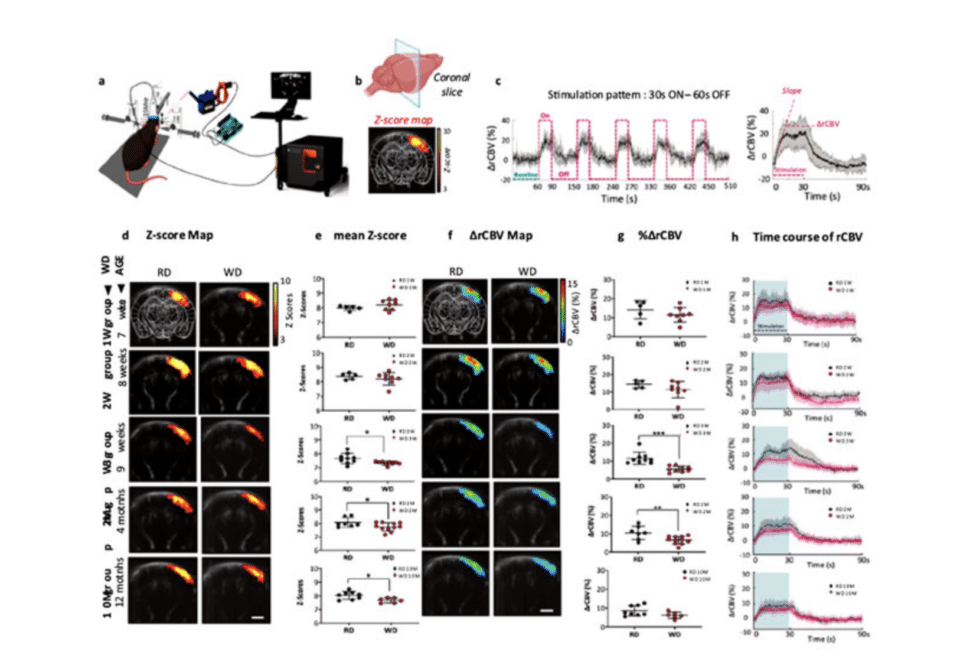 Using fUS to investigate the effect of diet on brain health