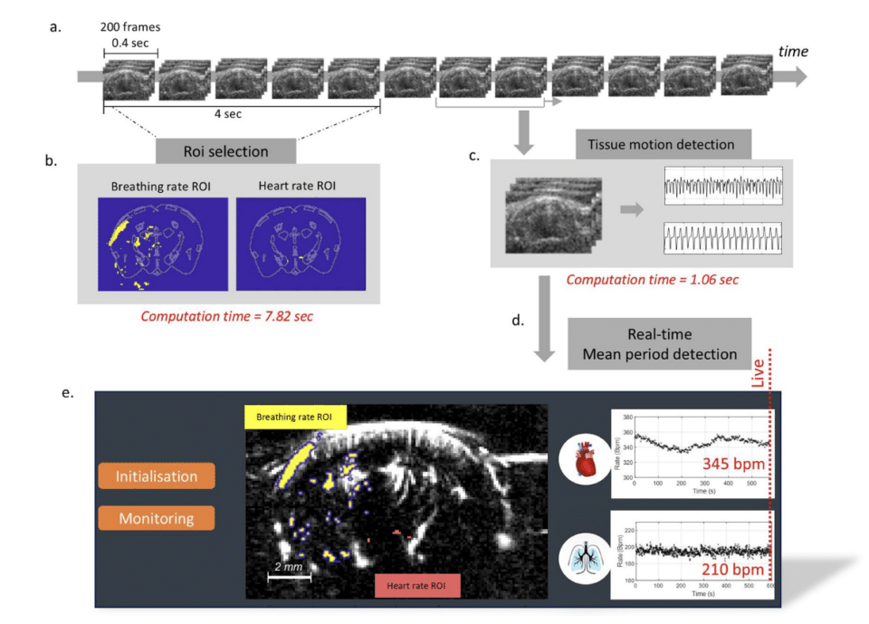 Physio-fUS: Using fUS imaging data to monitor breathing and heart-rate in real-time