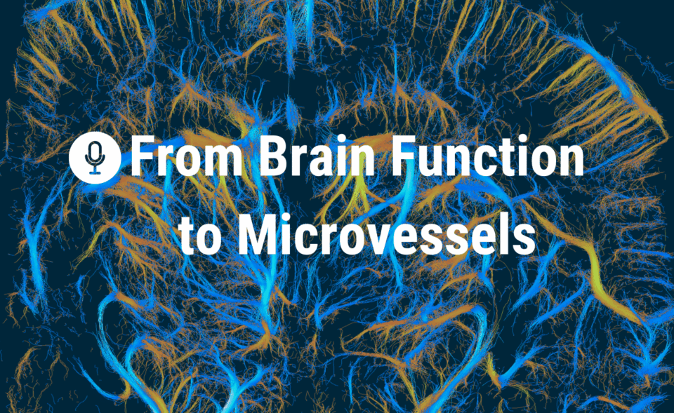 Upcoming Webinar – From Brain Function to Microvessels: Discover the Power of fUS & ULM