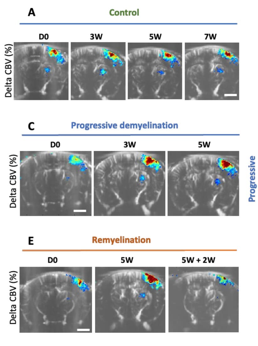 Academia–Pharma collaboration uses fUS to expand imaging options for preclinical studies of Multiple Sclerosis