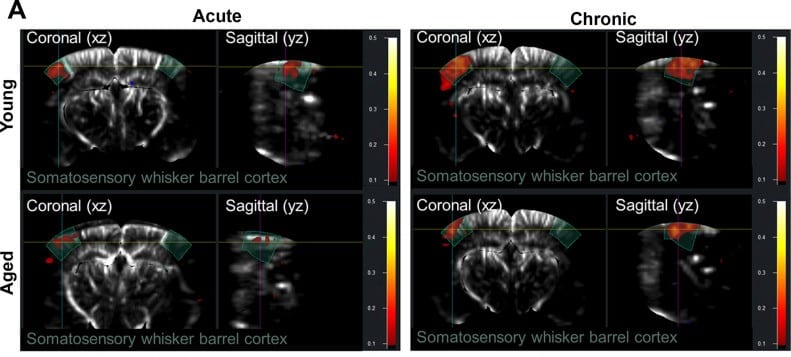 Using fUS to overcome the limitations of laser speckle contrast imaging for assessing functional hyperemia